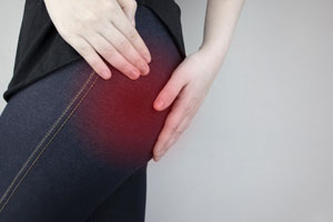 Piriformis Syndrome Treatment Doctors (Best Pain Specialists) Brooklyn