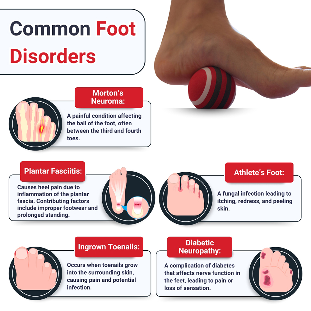 Common Foot Disorders